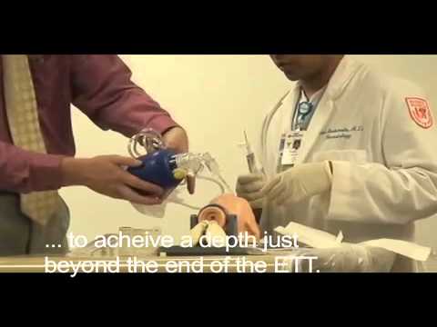 how to administer surfactant