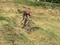 fratura-do-mogli