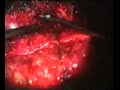 Operaci�n Hernia Discal emigrada L4-L5