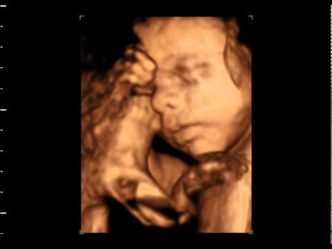 ultrasound 3d 4d - 4d ultrasound Video taken at GoldenView Ultrasound at 28 weeks gestation. GoldenView Ultrasound has 3d ultrasound facilities in San Antonio TX, New York City...