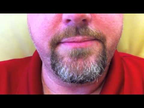 how to relieve one sided headache