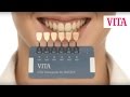 videos de easy shade taking: Zahnfarbe nehmen mit VITA Linearguide