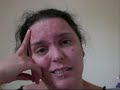 Day 1 of my 30 day challenge to stop touching my face in search of imperfections. No standing in front of the mirror finding bits to 