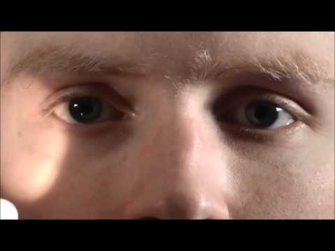 how to assess perrla