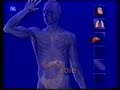 Transplantation