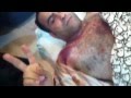 اعتداء الشرطة على حسن المرزوق بمسيرة الجمعيات-22-6-2012م