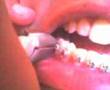Cebollin Dentista