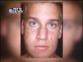 River Hills Teen Beaten On Halloween, No Charges Filed Yet