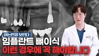 미래플란트치과