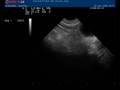 videos de Echo Lectra