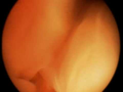 The Ultimate Guide Pregnancy part 2 of 5