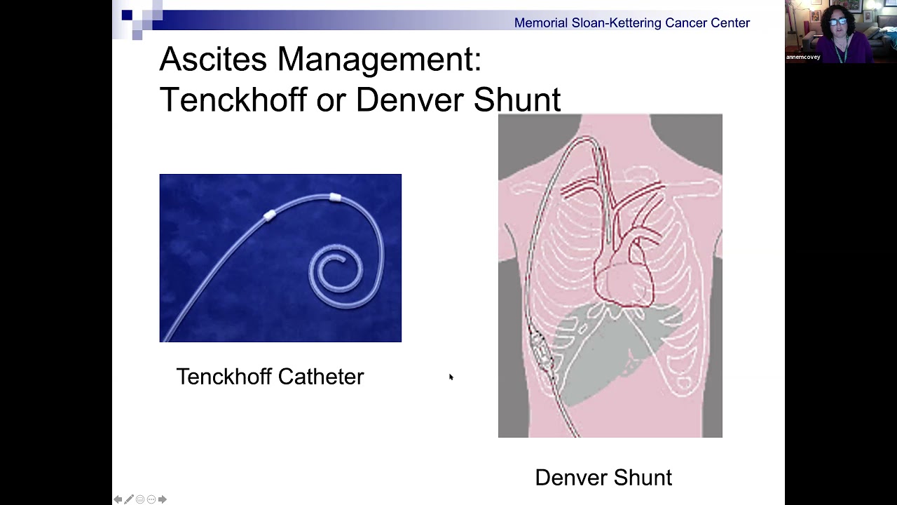 What is Interventional Radiology