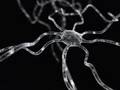 Dendrite