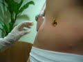 Mesotherapy- Mesolipo Mesotherapy- Mesolipo