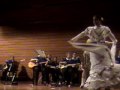 Down syndrome:&nbsp;S�ndrome de Down: Agrupaci�n Musical de Alasid interpreta Venezuela 