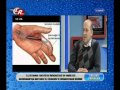 Click to View : Scofoid Kırığı Nedir ve Belirtileri Nelerdir ?