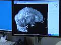 3D Technology Changing Way Patients Diagnosed At Local Hospi