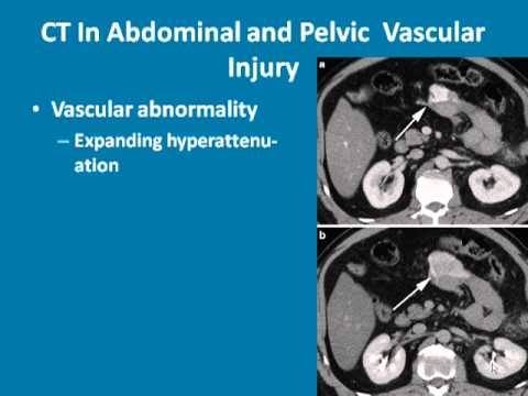 Presentation on Torso Trauma From the Emergency Medicine and Trauma Update 2010