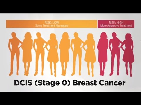 how to treat stage 0 breast cancer