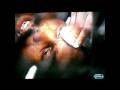 Vitor Belfort vs Marvin Eastman see the WORST cut in MMA