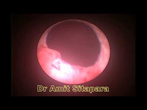 how to perform dmsa scan