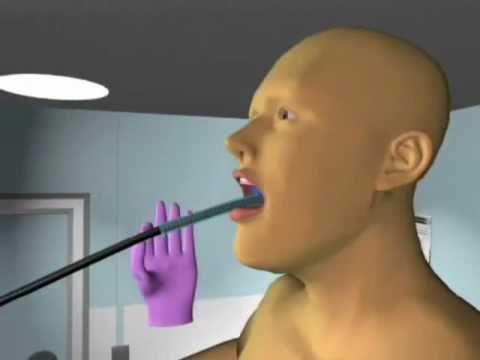 how to perform awake fiberoptic intubation