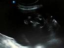 Baby Dossett is... A BOY!!! Baby Dossett is... A BOY!!!