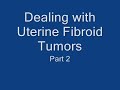Dealing with Uterine Fibroid Tumors - Part 2