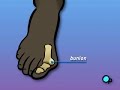 PreOp® Patient Education Orthopedic: Bunion Removal Foot