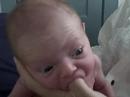 Failure to burp