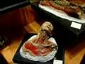 Mutter Museum on Weird US
