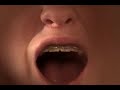 8.mov