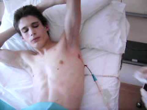 how to drain pneumothorax