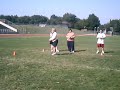 Down syndrome:&nbsp;Down Syndrome: Special Olympics bocce