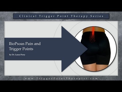 how to treat iliacus pain
