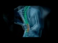 Duluth, GA Neck Pain Relief - Dr Joseph Hans