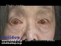 buildup DEMOREEL2006 -film- buildup DEMOREEL2006 -film-