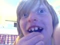 Thumbnail #1