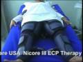 videos de External Counter Pulsation