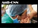 Anti -CNN??????????????,?????????? Anti -CNN??????????????,??????????