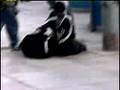 videos de EPILEPSIA