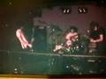 silver spoon eyeball - live