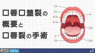 口唇口蓋裂の基礎知識と治療・ケアを学ぶ 第1回~口唇口蓋裂の基礎と口唇裂の手術~
