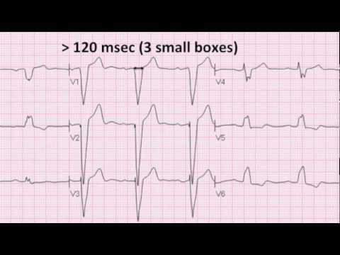how to treat lbbb
