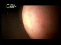 Documental de National Geographic sobre el embarazo. En español.