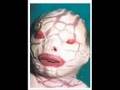 videos de doenças raras