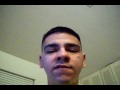 Upper Jaw Surgery 2 (Pre-Surgery) Upper Jaw Surgery 2 (Pre-Surgery)
