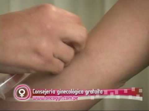 Inseminación Intrauterina 0 Inseminación Intrauterina