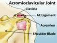 Understanding Shoulder Pain (Sports Injuries #3)