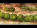 Immune System - Fighting Infection by Clonal Selection